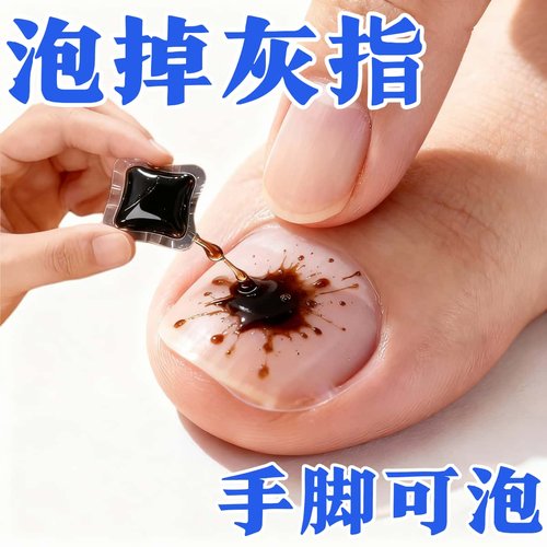 【香港专研】免熬煮灰指凝珠专用泡甲杀真 [菌]手脚指泡脚袋足液