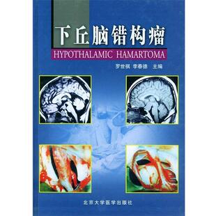 罗世祺,李春德 主编下丘脑错构瘤(正版旧书包邮)北京大学医学出版社9787810715997