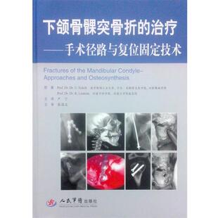 (德)埃克尔特,(德)洛克塔 原著,严宁下颌骨髁突骨折的治疗 手术径路与复位固定技术（正版旧书包邮）人民军医出版社9787509170380