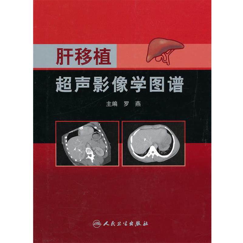 罗燕 主编肝移植超声影像学图谱（正版旧书包邮）人民卫生出版社9787117127639