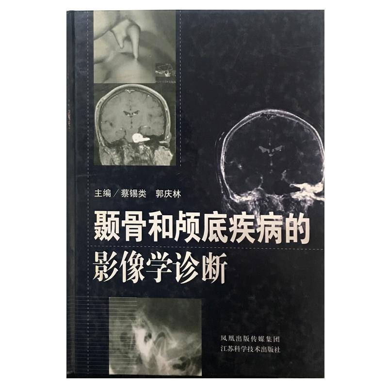 蔡锡类,郭庆林　主编颞骨和颅底疾病的影像学诊断（正版旧书包邮）江苏科学技术出版社9787534556449