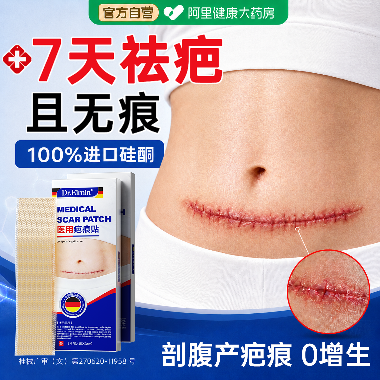 进口硅酮】剖腹产祛疤贴NO.I