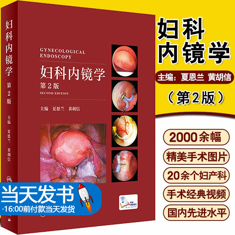 妇科妇科病内窥镜宫腹腔镜手术