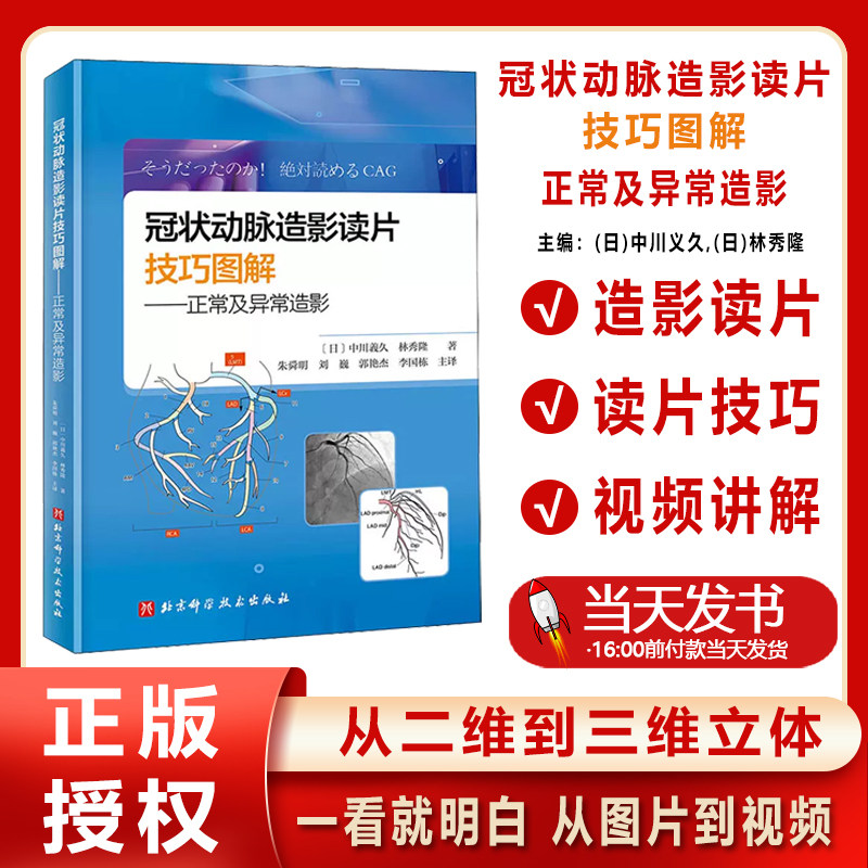 冠状动脉造影读片技巧图解