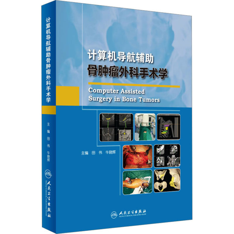 计算机导航辅助骨肿瘤外科手术学田伟,牛晓辉 编人民卫生出版社9787117236652外科学