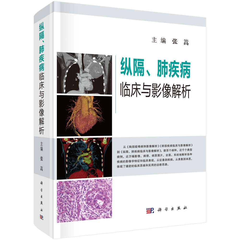 纵隔、肺疾病临床与影像解析张嵩科学出版社9787030594679医学卫生/医学其它