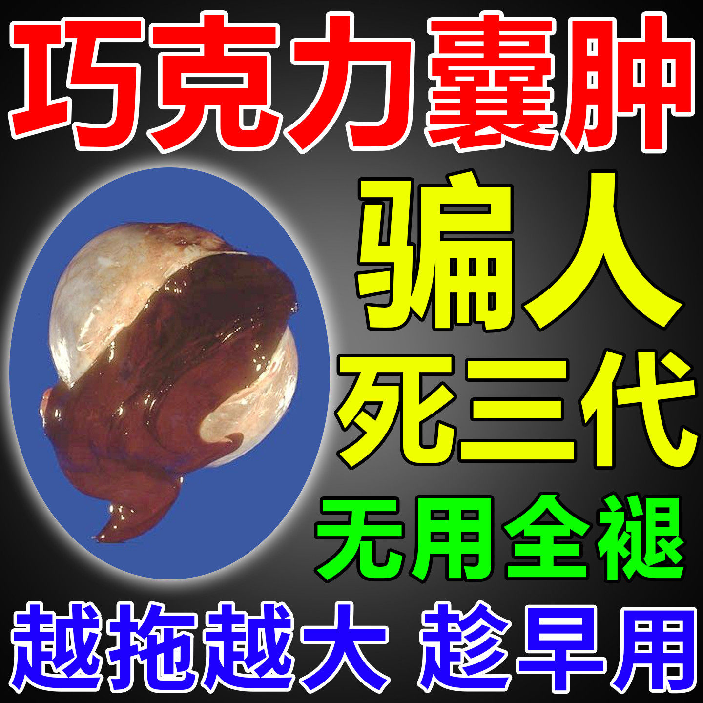 巧克力卵巢囊肿的中膏药贴调理宫颈囊肿子宫肌瘤泡脚包消暖宫贴