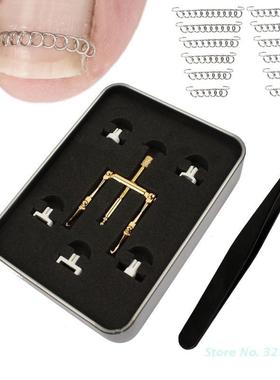 Ingrown Toenail Recover Clips Corrector Tweezer Nail