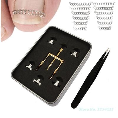 Ingrown Toenail Recover Clips Corrector Tweezer Nail