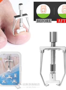 *Ingrown Toe Nail Correction Lifter Pedicure Toenail Fixer R