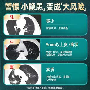 自营HerHPBbsfG】old槲皮素高含量畅快呼吸【护肺进o口和丽康 60