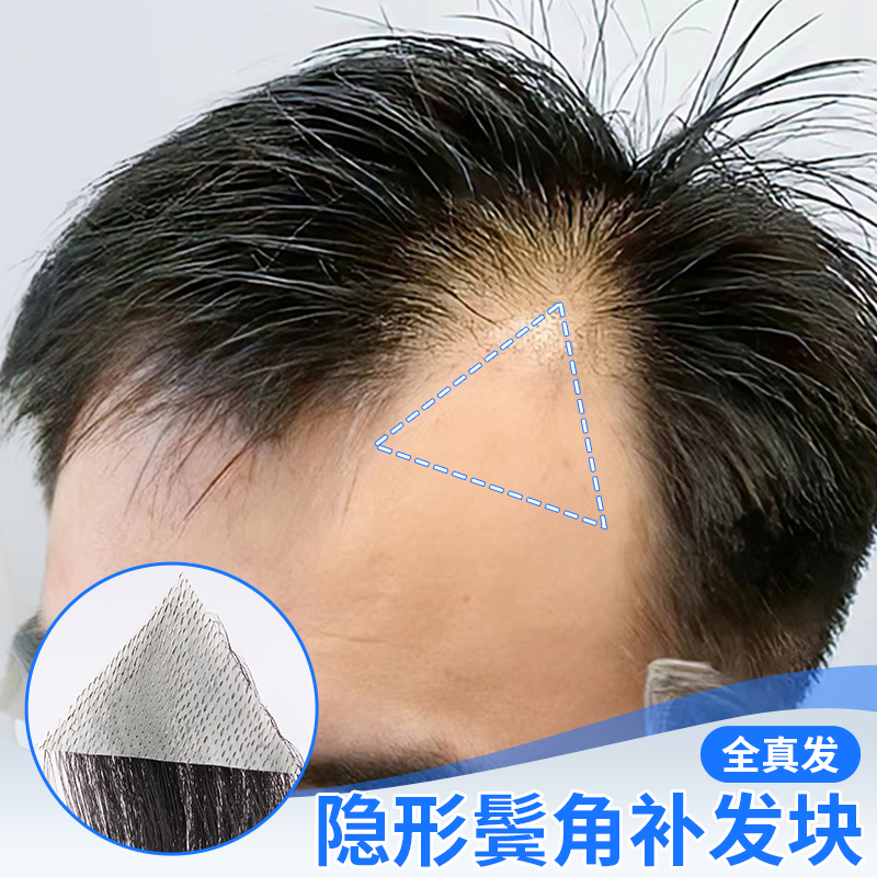 男士假浏海片鬓角补发假发片男女全真人发m型前额发际线假发贴片