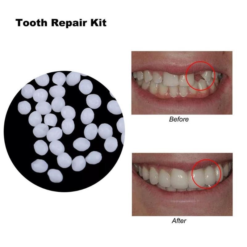 Denture Adhesive Tooth-Repair-Kit Solid-Glue Dental-Rest