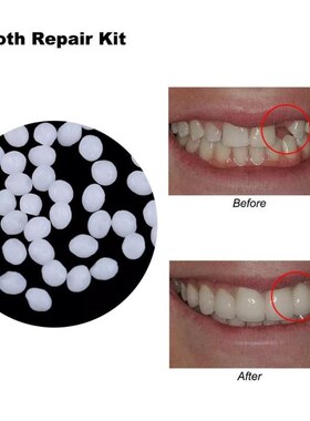 Denture Adhesive Tooth-Repair-Kit Solid-Glue Dental-Rest