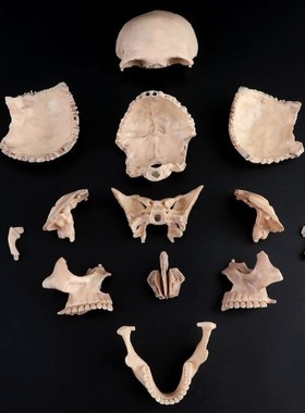 15pcs/set 4D Disassembled Color Skull Anatomical Model Detac