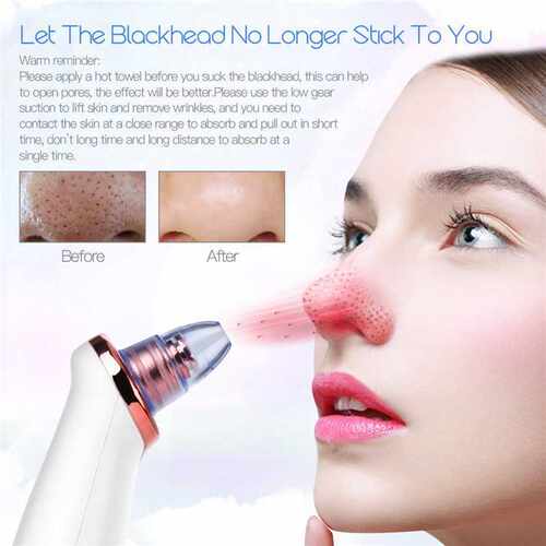 Pore-Cleaner Facial-Tools Face Cleansing Blackhead-Remover S