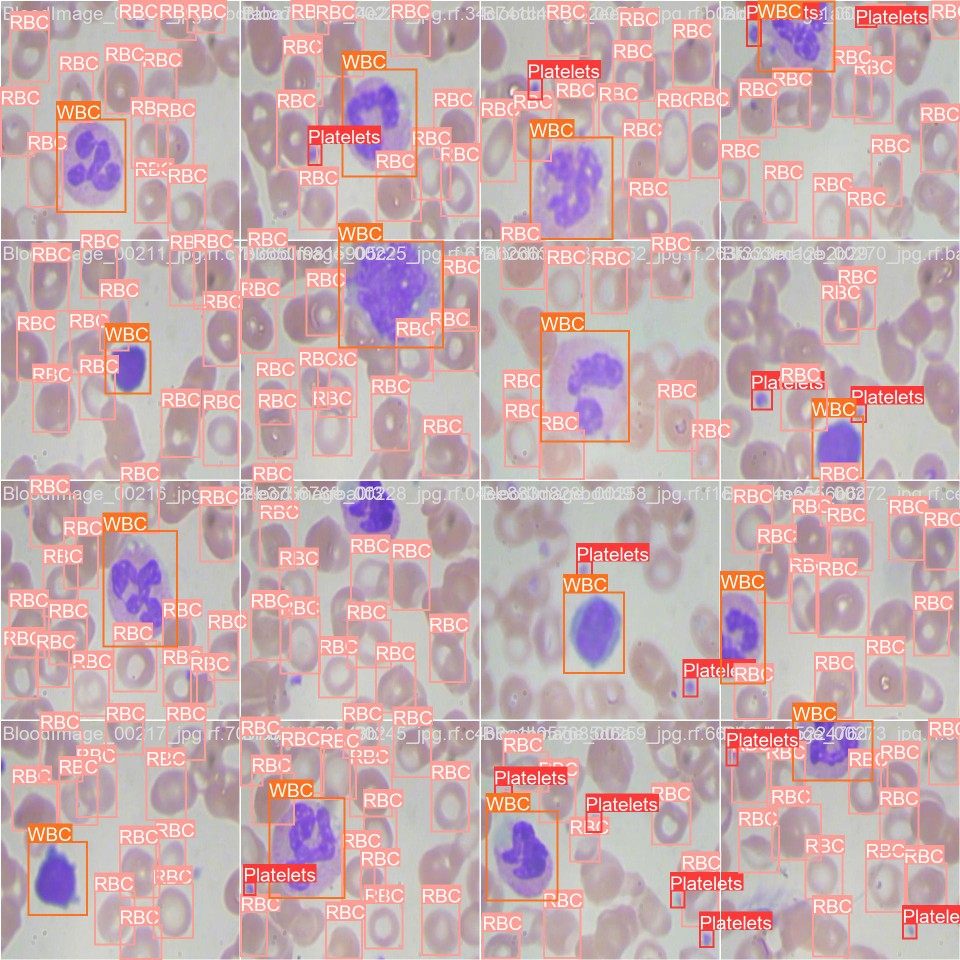 基于YOLOv8的血细胞检测cancer cell  detection源码含数据集