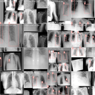 基于YOLOv8的Covid-19肺部medical图像检测源码实现含数据集