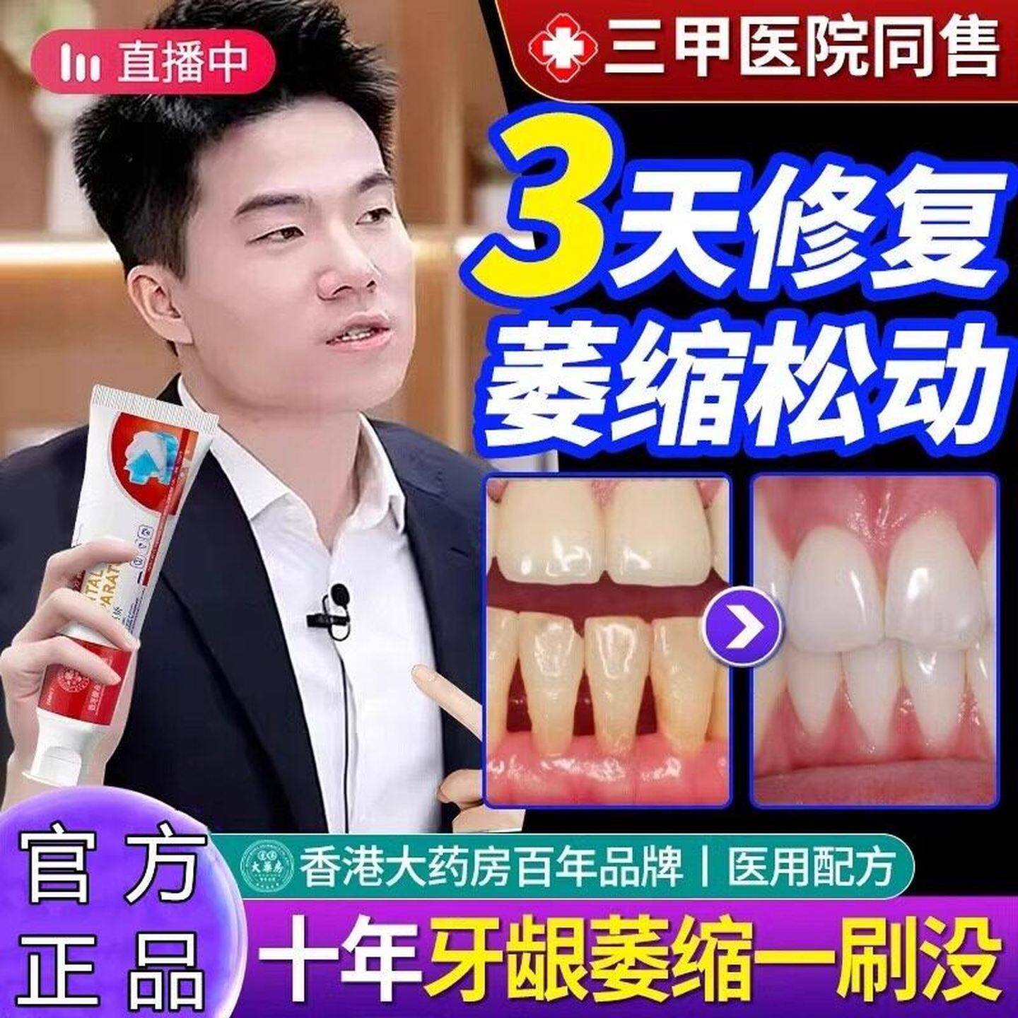 香港修复牙龈牙齿松动再出血牙周炎萎缩固齿抗敏牙膏生硅官方正品