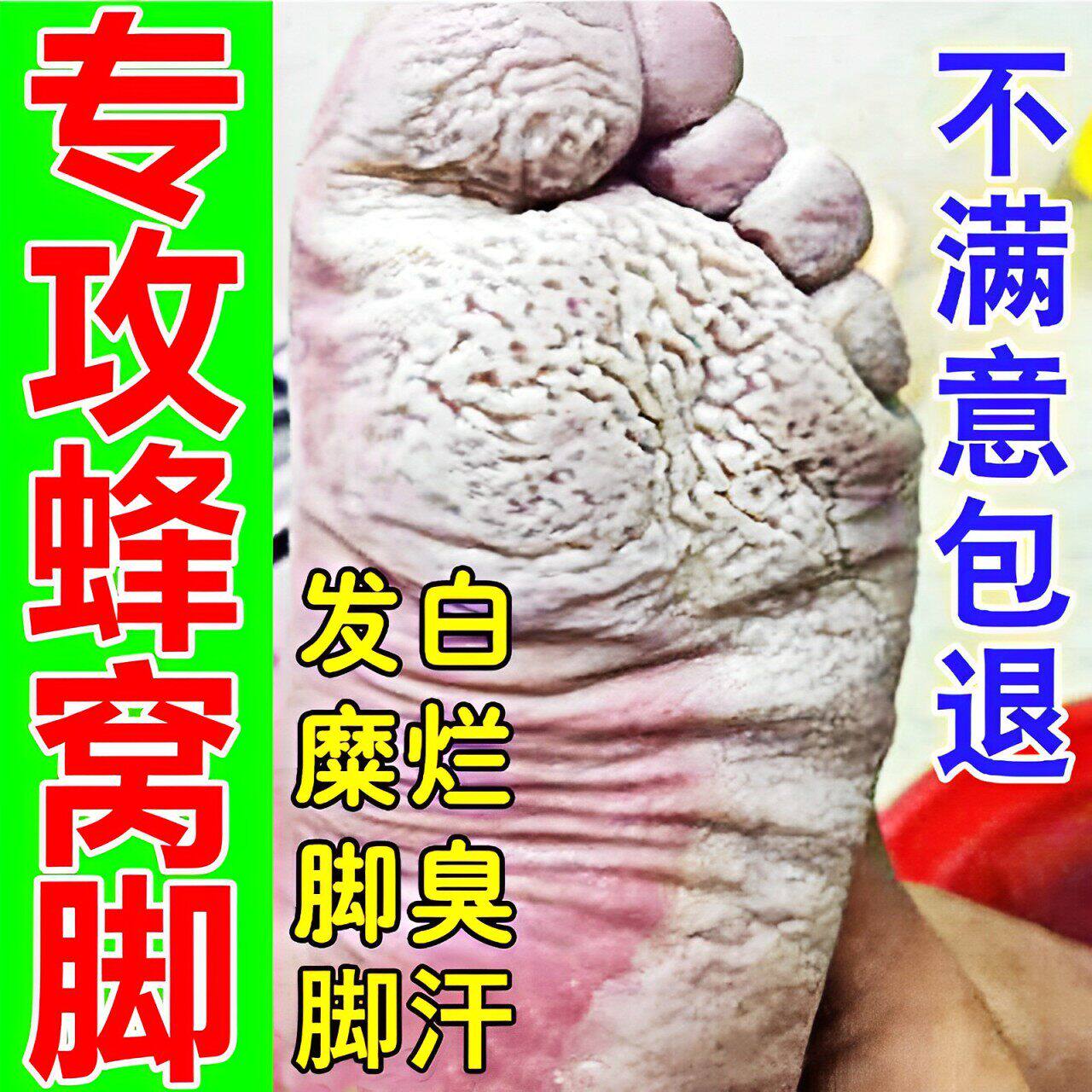 窝状角质松解症药脚底起泡蜂窝状沙虫脚脚出汗臭脚止汗止痒抑菌膏