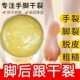 足部干裂霜足膏脚后跟防裂龟裂纹缓解冻疮身体痒乳保湿 滋润外用
