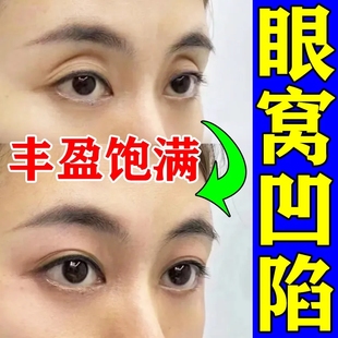 泪沟填充神器眼窝凹陷修复眼贴眼窝凹陷修复神器眼窝凹陷修复填充