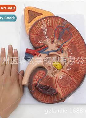 Human Extra Large Kidney Anatomy Model 3X Magnification Kidn