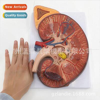 Human Extra Large Kidney Anatomy Model 3X Magnification Kidn