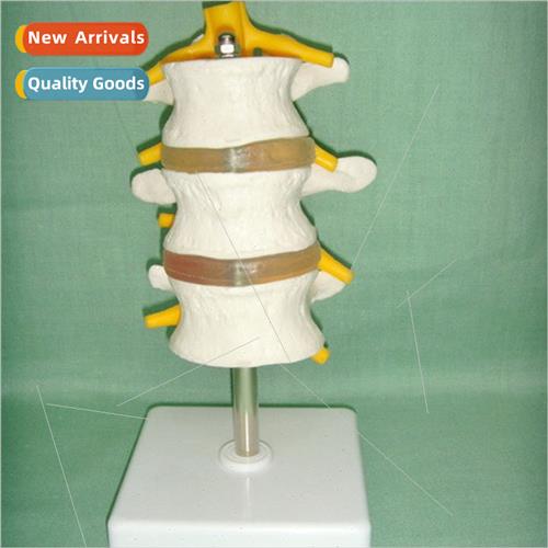 mbar spine model three lumbar vertebrae spine model lumbar v