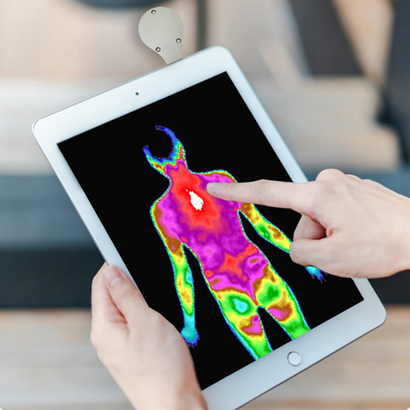 热成像仪手持式中医热CT天玑红外