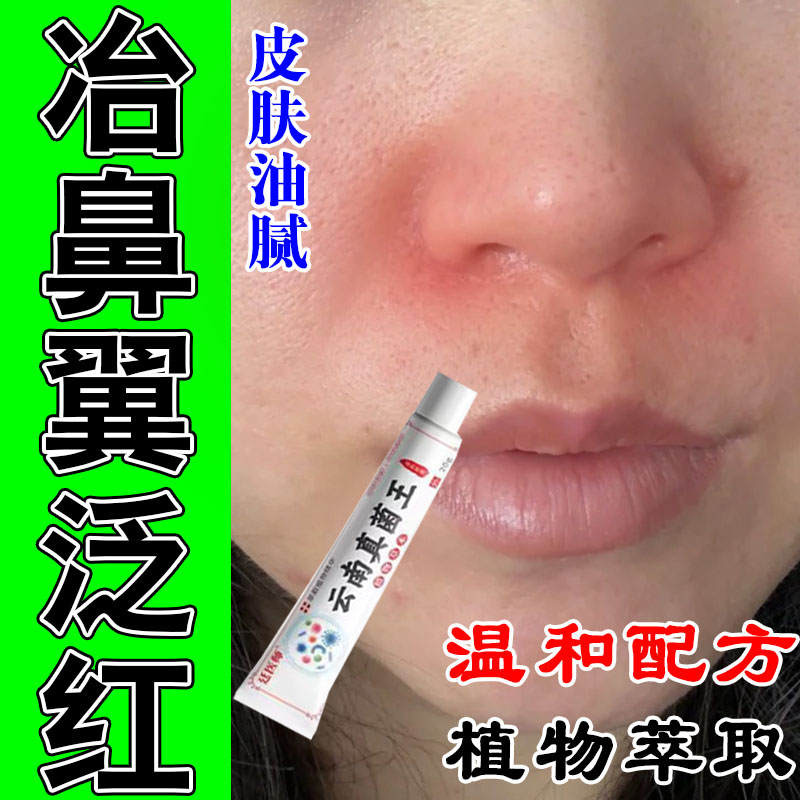 脂溢性脸红鼻子泛红干燥起皮发痒脂溢性鼻侧发红起皮草本修复软膏