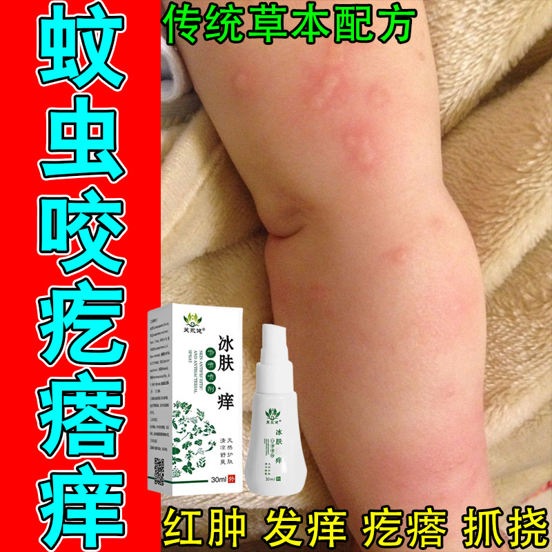 孩子腿红疙瘩痒天热蚊虫叮咬疙瘩痒腿上过敏红夏天皮肤红疙瘩喷剂