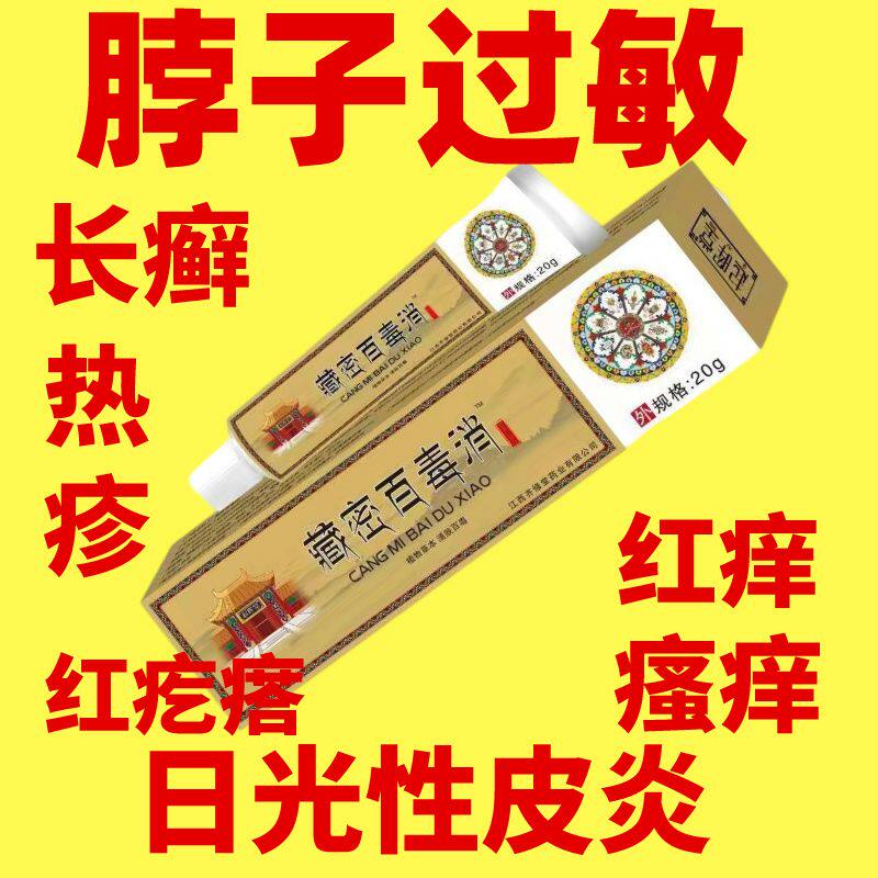 癣皮炎脖子脖子皮炎捞癣脖子痒神经性抓上长脖子起癣痒痒皮癣