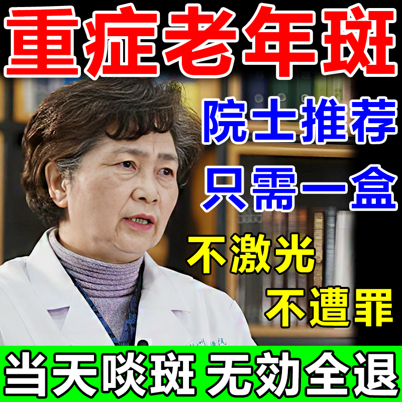 男士祛斑霜祛黄褐斑老年斑手部脸部强力祛除老年斑雀斑专用却斑霜