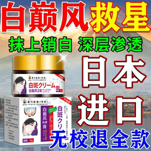 白风癜膏药快速消白斑专用促黑色素生长外用白斑软膏