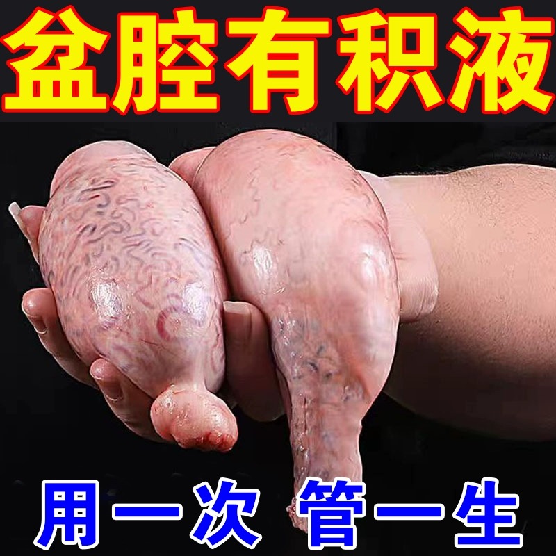 盆腔输积水积液排出卵输管疏不通热敷包通而不畅黏连堵塞热敷包贴