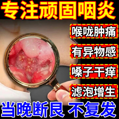 咽喉炎慢性咽炎除跟买2送一