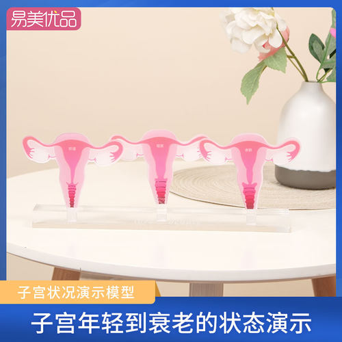 子宫状态演示产康教学医用模型