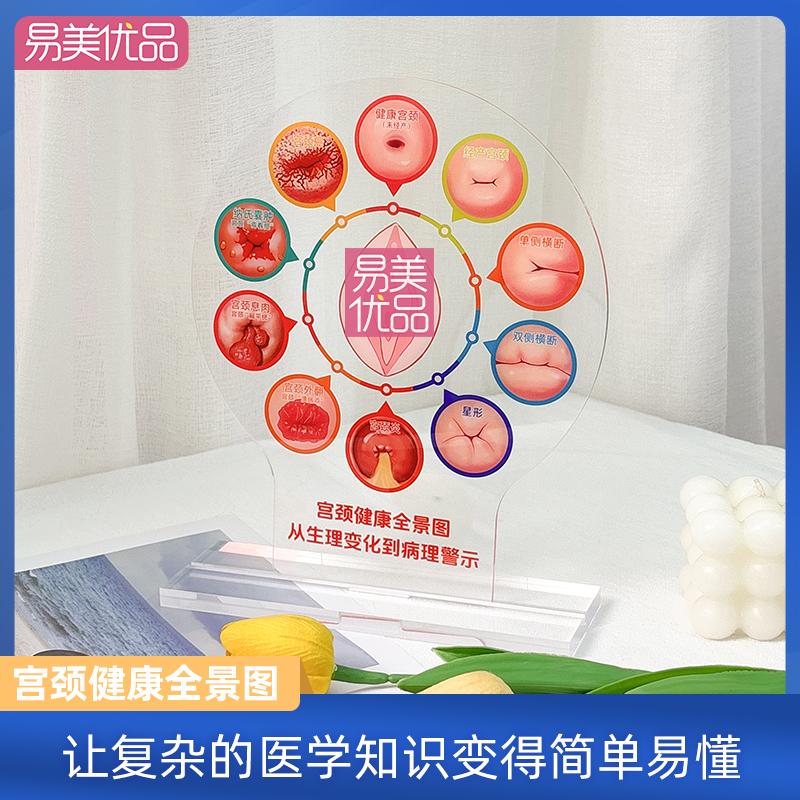 亚克力宫颈健康图美容院互动工具营销利器女性健康知识普及咨询区