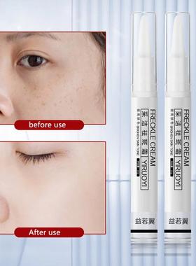 Instant Blemish Removal Gel  Whitening Freckle Cream Pen Bri