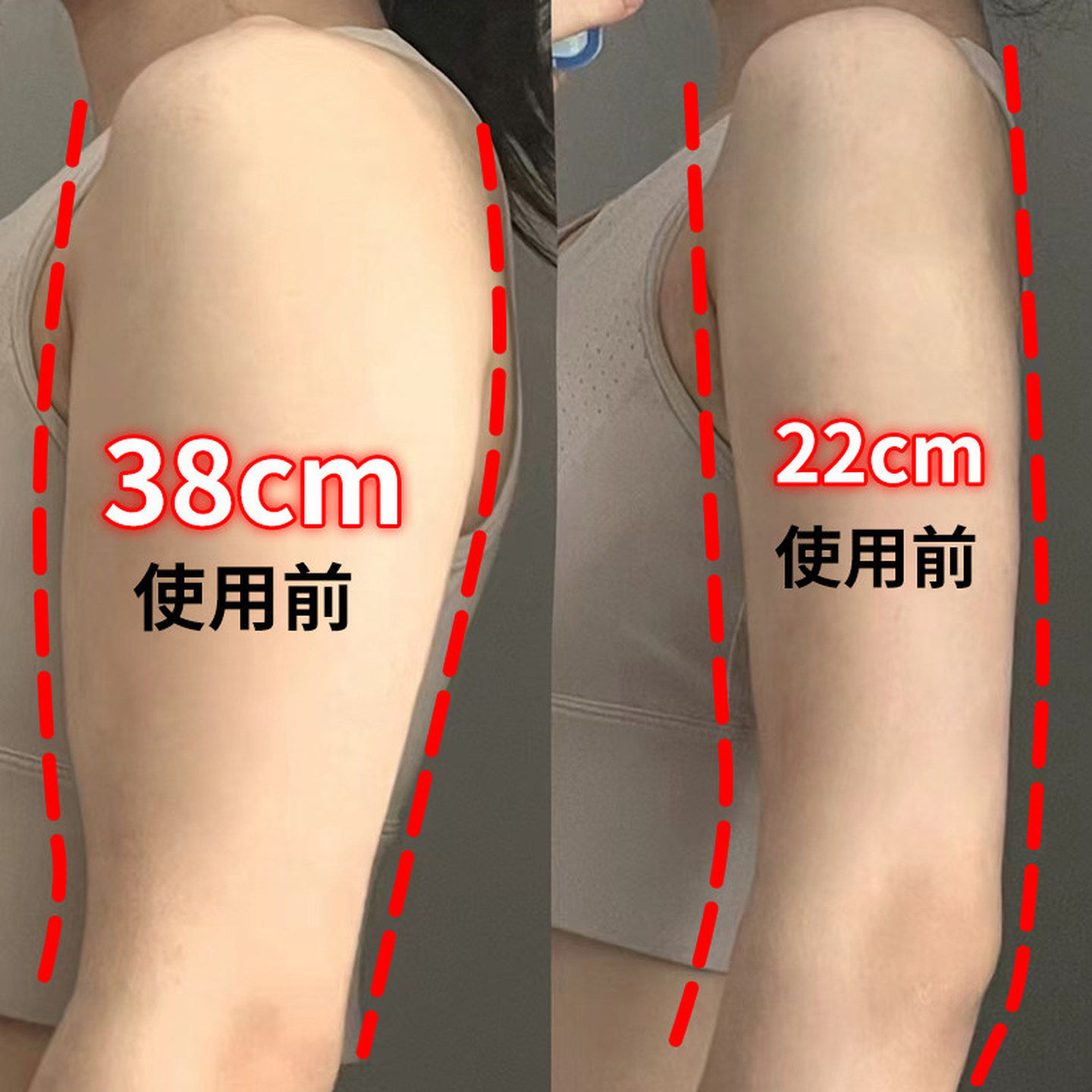 快速去手臂神器 女神贴大粗胳膊细蝴蝶懒人专用 买5送5 多买多送