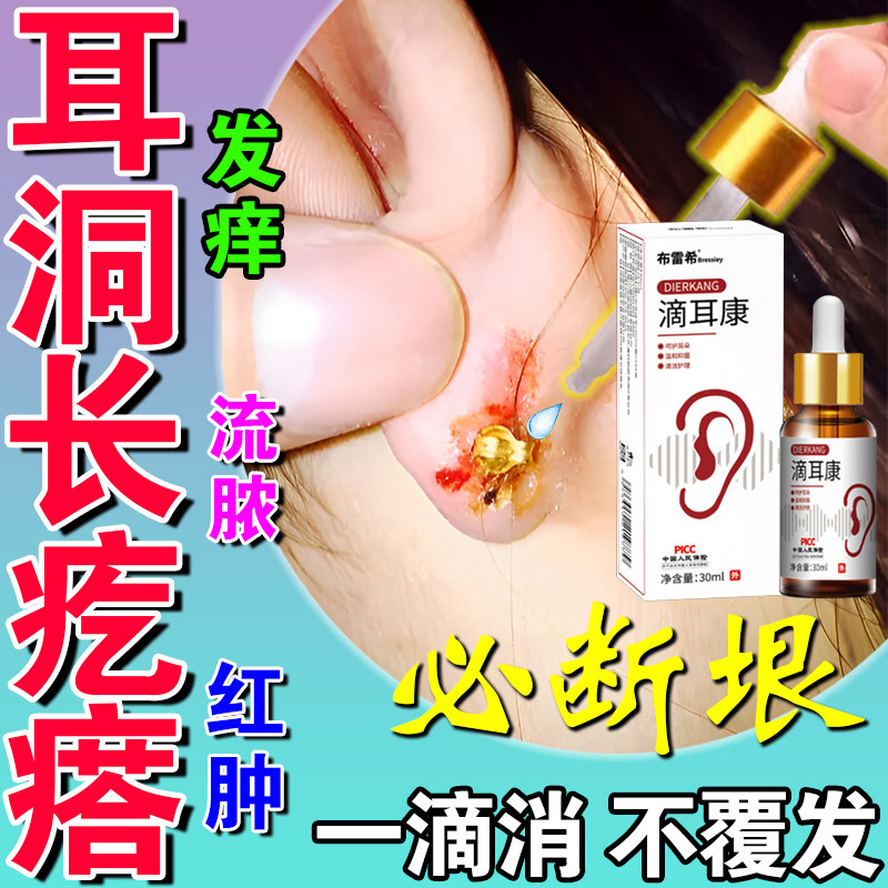 耳洞增生疤痕疙瘩去除护理液神器耳朵发流脓红肿闭塞清洗修复神器