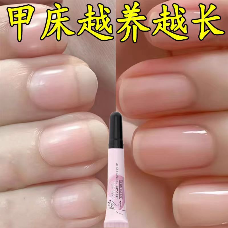 自然真指甲修护增厚防断营养液