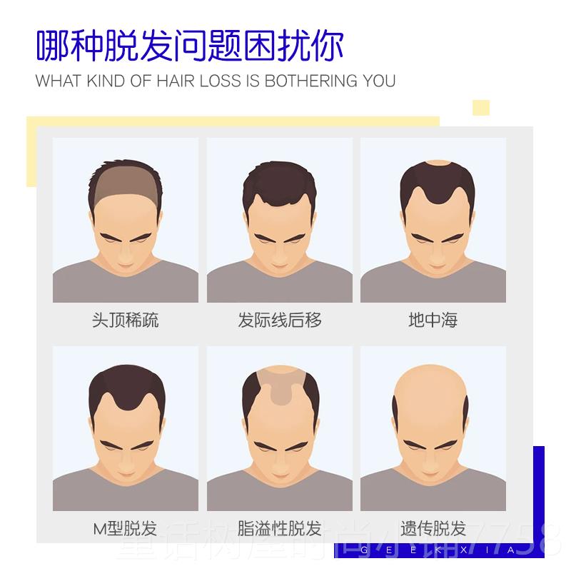 正品木极客侠假L发无隐形补发男际线男士定痕制真发头顶假发片补