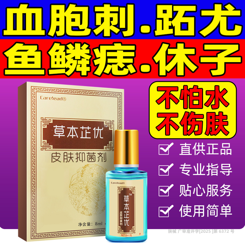 草本芷优去除血胞刺刺猴鱼鳞痣