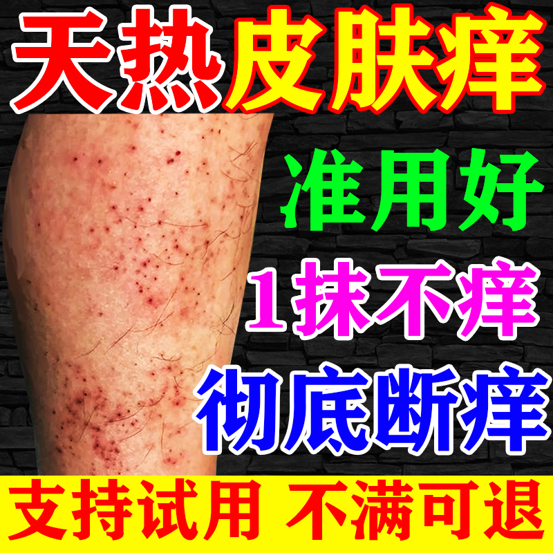 天热皮肤痒一抹见效100%断裉药膏