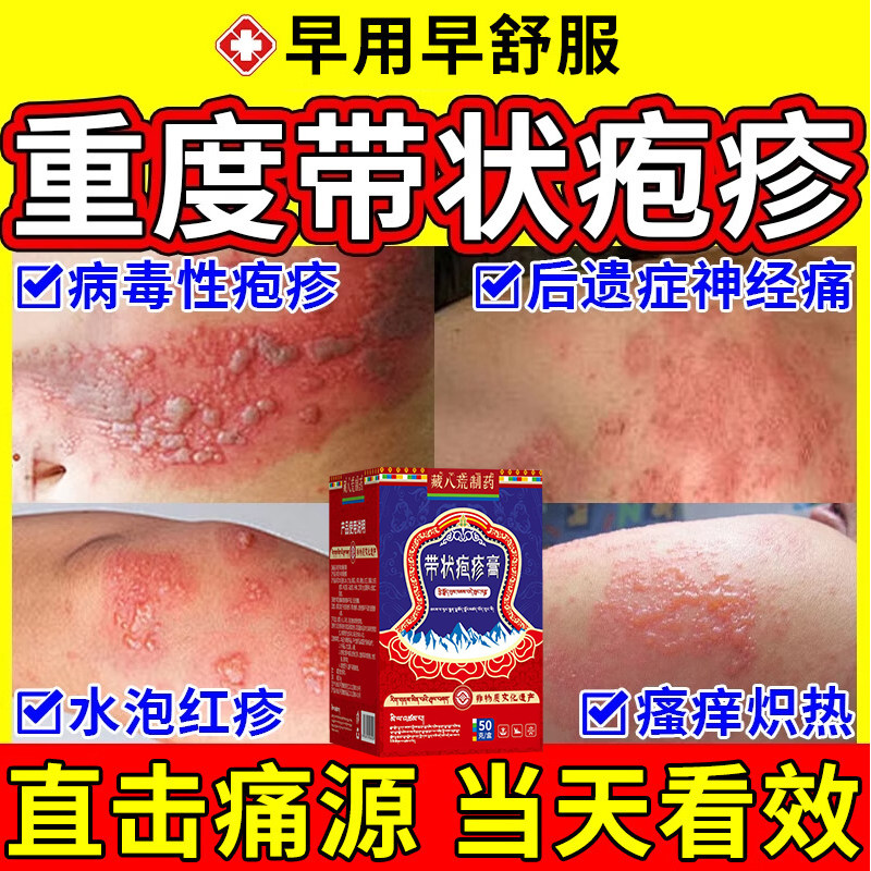 100%解决带状疱1疹后遗症神经痛