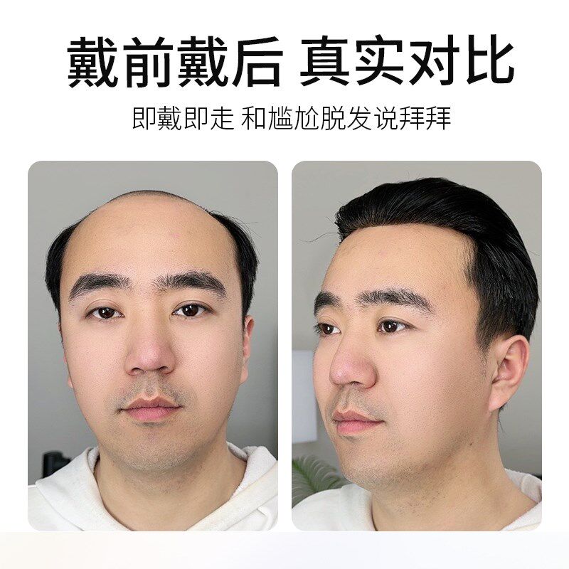 假发男士头顶补发递针全真发织发块秃顶肤化发际线隐形无痕短毛寸