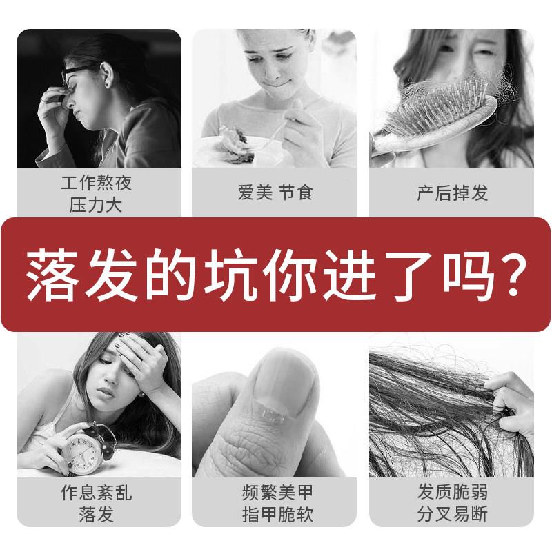 iHebner郝柏娜德国硅素u生物素硒增发饮sicea护发养GTFl发红果*3