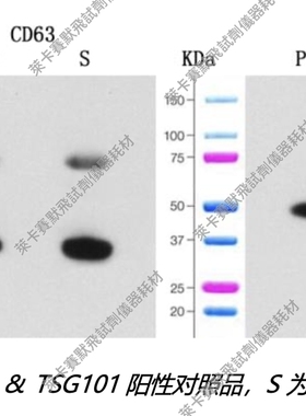 umibio®外泌体CD63&TSG101蛋白检测试剂盒 适用外泌体蛋白检测WB